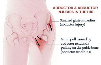 Adductors and Abductor Stretches for Hip Injuries