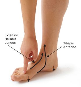 Bunion Pain Relief