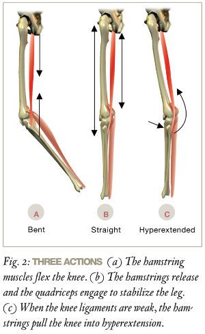 sore hamstrings