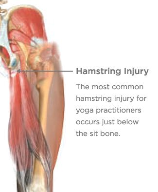 hamstring injury